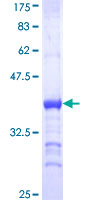 ab158071 on a 12.5% SDS-PAGE stained with Coomassie Blue.