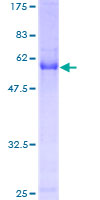 ab164399 on a 12.5% SDS-PAGE stained with Coomassie Blue.