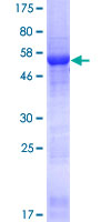 ab162941 on a 12.5% SDS-PAGE stained with Coomassie Blue.