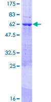 ab164993 on a 12.5% SDS-PAGE stained with Coomassie Blue.