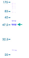 ab160982 on a 12.5% SDS-PAGE stained with Coomassie Blue.