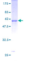 ab158068 on a 12.5% SDS-PAGE stained with Coomassie Blue.