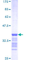 ab158069 on a 12.5% SDS-PAGE stained with Coomassie Blue.
