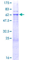 ab160098 on a 12.5% SDS-PAGE stained with Coomassie Blue.