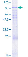 ab162623 on a 12.5% SDS-PAGE stained with Coomassie Blue.