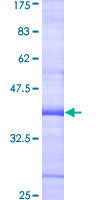 ab162624 on a 12.5% SDS-PAGE stained with Coomassie Blue.