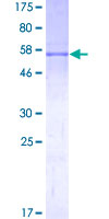 ab158084 on a 12.5% SDS-PAGE stained with Coomassie Blue.