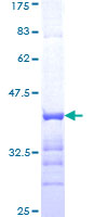 ab158085 on a 12.5% SDS-PAGE stained with Coomassie Blue.