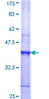 ab158086 on a 12.5% SDS-PAGE stained with Coomassie Blue.