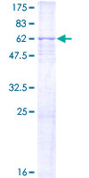 ab158087 on a 12.5% SDS-PAGE stained with Coomassie Blue.