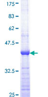 ab158088 on a 12.5% SDS-PAGE stained with Coomassie Blue.