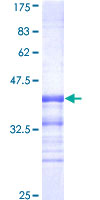 ab158089 on a 12.5% SDS-PAGE stained with Coomassie Blue.