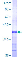ab160206 on a 12.5% SDS-PAGE stained with Coomassie Blue.