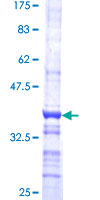 ab166311 on a 12.5% SDS-PAGE stained with Coomassie Blue.
