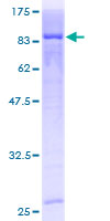 ab163139 on a 12.5% SDS-PAGE stained with Coomassie Blue.