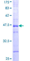 ab162378 on a 12.5% SDS-PAGE stained with Coomassie Blue.