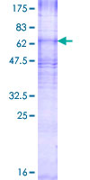 ab160175 on a 12.5% SDS-PAGE stained with Coomassie Blue.