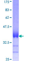 ab160176 on a 12.5% SDS-PAGE stained with Coomassie Blue.