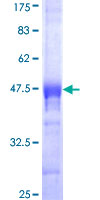 ab158092 on a 12.5% SDS-PAGE stained with Coomassie Blue.