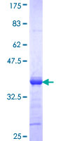 ab160483 on a 12.5% SDS-PAGE stained with Coomassie Blue.