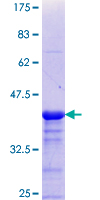 ab152984 on a 12.5% SDS-PAGE stained with Coomassie Blue.