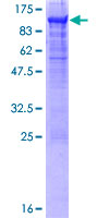 ab158095 on a 12.5% SDS-PAGE stained with Coomassie Blue.