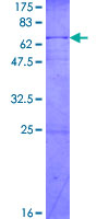 ab158096 on a 12.5% SDS-PAGE stained with Coomassie Blue.