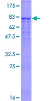 ab162433 on a 12.5% SDS-PAGE stained with Coomassie Blue.