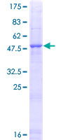 ab158343 on a 12.5% SDS-PAGE stained with Coomassie Blue.