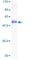 ab161644 on a 12.5% SDS-PAGE stained with Coomassie Blue.