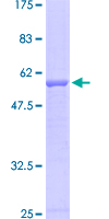 ab161645 on a 12.5% SDS-PAGE stained with Coomassie Blue.