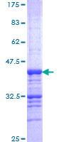 ab158336 on a 12.5% SDS-PAGE stained with Coomassie Blue.