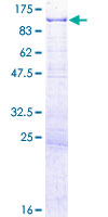 ab152272 on a 12.5% SDS-PAGE stained with Coomassie Blue.