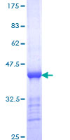ab158097 on a 12.5% SDS-PAGE stained with Coomassie Blue.
