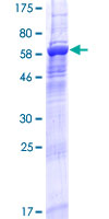 ab164874 on a 12.5% SDS-PAGE stained with Coomassie Blue.