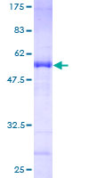 ab163249 on a 12.5% SDS-PAGE stained with Coomassie Blue.