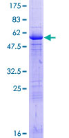 ab166501 on a 12.5% SDS-PAGE stained with Coomassie Blue.