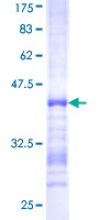 ab161673 on a 12.5% SDS-PAGE stained with Coomassie Blue.