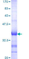 ab160635 on a 12.5% SDS-PAGE stained with Coomassie Blue.