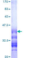 ab165118 on a 12.5% SDS-PAGE stained with Coomassie Blue.