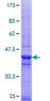 ab164215 on a 12.5% SDS-PAGE stained with Coomassie Blue.