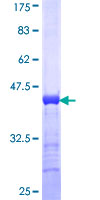ab153011 on a 12.5% SDS-PAGE stained with Coomassie Blue.