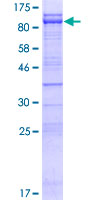 ab164167 on a 12.5% SDS-PAGE stained with Coomassie Blue.