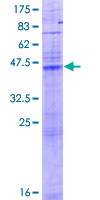 ab161118 on a 12.5% SDS-PAGE stained with Coomassie Blue.