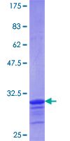 ab161119 on a 12.5% SDS-PAGE stained with Coomassie Blue.