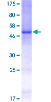 ab153492 on a 12.5% SDS-PAGE stained with Coomassie Blue.