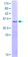 ab152919 on a 12.5% SDS-PAGE stained with Coomassie Blue.