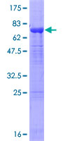 ab153432 on a 12.5% SDS-PAGE stained with Coomassie Blue.