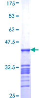 ab153433 on a 12.5% SDS-PAGE stained with Coomassie Blue.