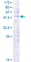 ab163293 on a 12.5% SDS-PAGE stained with Coomassie Blue.